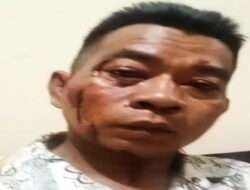 Miris, Hampir Mati Dikeroyok, Wartawan Sumenep Malah Dijadikan Tersangka Penganiayaan