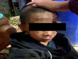 Sadis! Anak 13 Tahun Dianiaya Berat di Ketapang, Polisi Tangani Kasusnya
