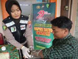 Polres Situbondo Beri Layanan Hapus Tato Gratis di Hari Bhayangkara ke -79